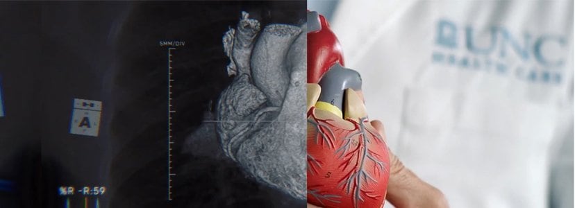x-ray of heart paired next to model of heart